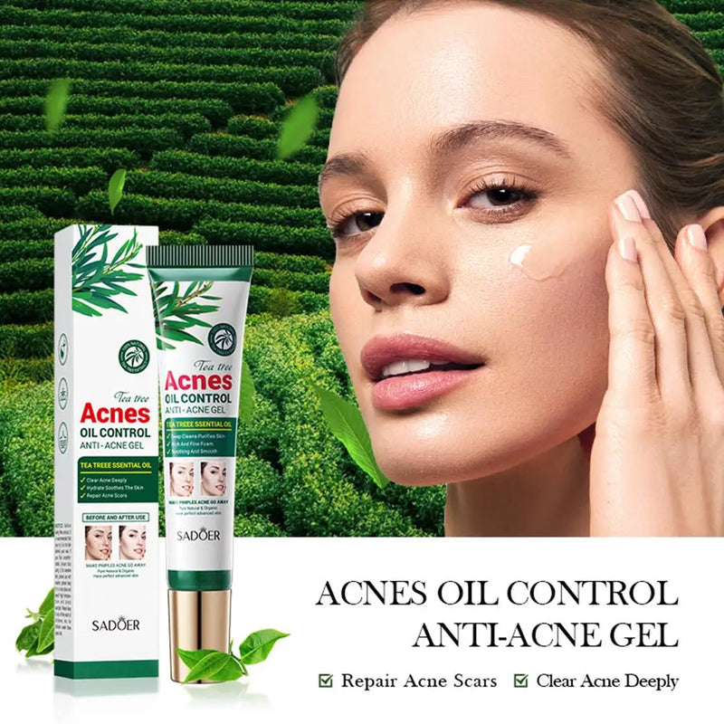 Tea Tree Anti Acne cream Gel