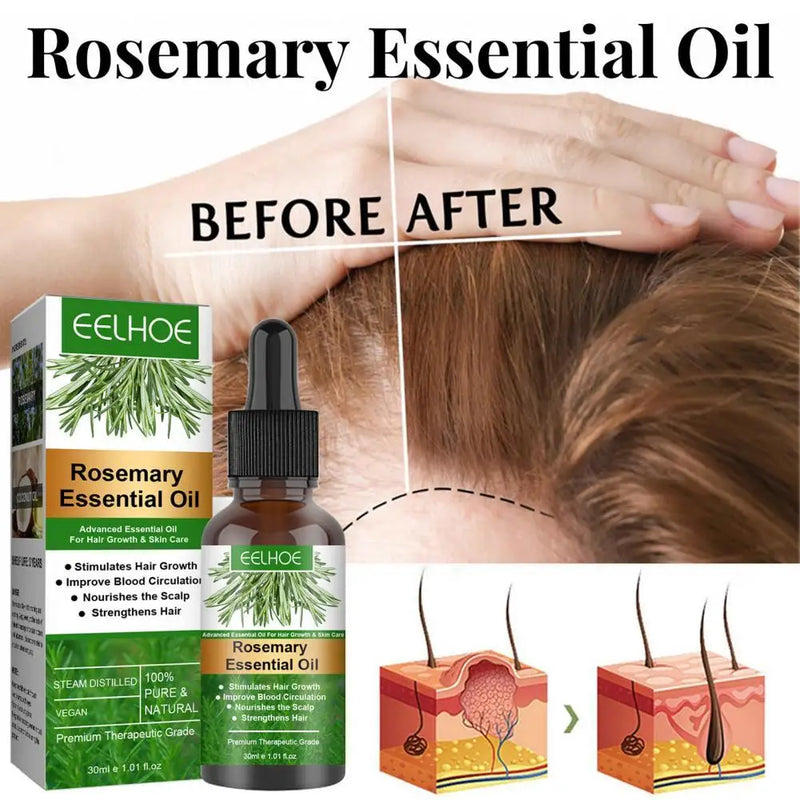 Rosemary Hair Essential Oil for Hair Growth and Anti Hair Loss