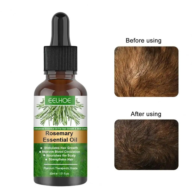 Rosemary Hair Essential Oil for Hair Growth and Anti Hair Loss