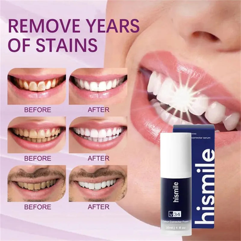 Hismile Toothpaste, Tooth Cleansing, Teeth Whitening Oral Dental Mousse Toothpaste