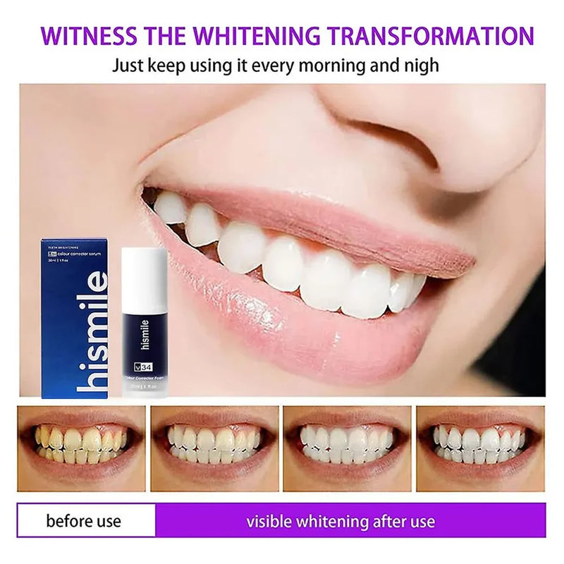 Hismile Toothpaste, Tooth Cleansing, Teeth Whitening Oral Dental Mousse Toothpaste