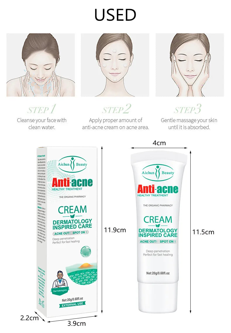 Anti Acne Face Cream for Acne & Blemish, Acne Spot and Acne scars Treatment