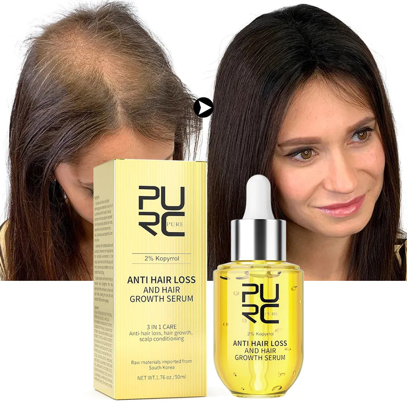 PURC Anti Hair Loss and Hair Growth Serum for Men and Women