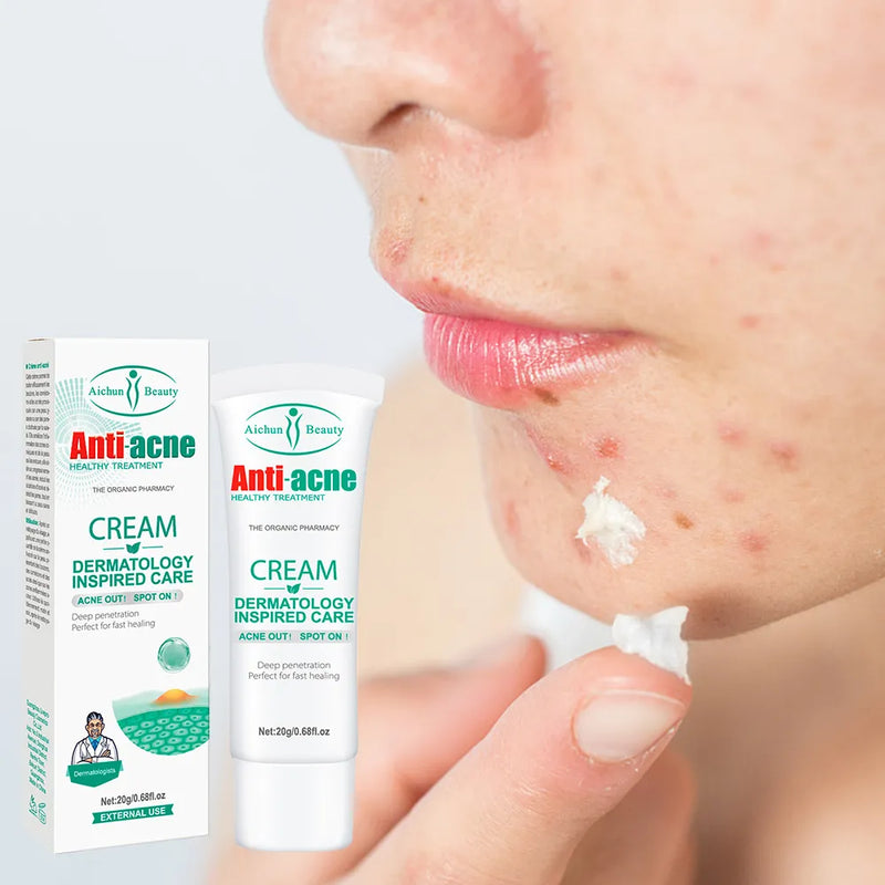 Anti Acne Face Cream for Acne & Blemish, Acne Spot and Acne scars Treatment