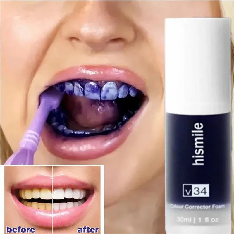 Hismile Toothpaste, Tooth Cleansing, Teeth Whitening Oral Dental Mousse Toothpaste